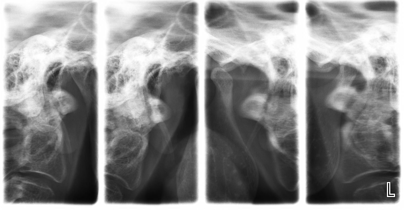 Radiografia de ATM